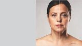 derma corpo e estetica fotoenvelhecimento