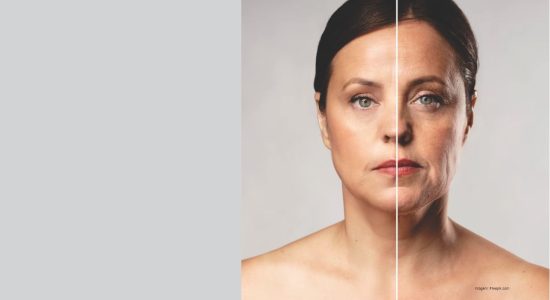 derma corpo e estetica fotoenvelhecimento