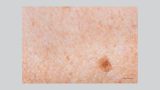 derma corpo e estetica site melasma ação clareadora
