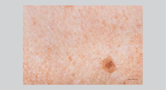 derma corpo e estetica site melasma ação clareadora